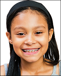 Children's Orthodontics - Braces - Kids Dental Office in Brampton