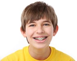 Children's Orthodontics - Braces - Kids Dental Office in Brampton