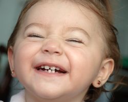 Primary Teeth are essential to oral development - Child Friendly Dental Office in Brampton